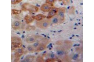 IHC-P analysis of Liver tissue, with DAB staining. (AGR2 抗体  (AA 21-175))