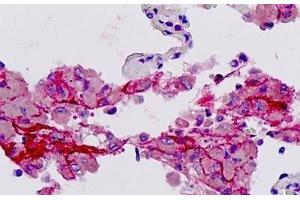 Immunohistochemistry (IHC) image for anti-Coagulation Factor II (thrombin) Receptor (F2R) (AA 23-72), (Cleaved-Ser42) antibody (ABIN2879291)