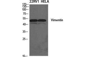 Western Blot (WB) analysis of specific cells using Vimentin Polyclonal Antibody. (Vimentin 抗体  (Tyr317))