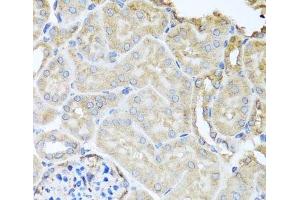 Immunohistochemistry of paraffin-embedded Mouse kidney using MYLK Polyclonal Antibody at dilution of 1:100 (40x lens). (MYLK 抗体)