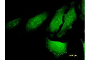 Immunofluorescence of monoclonal antibody to RERG on HeLa cell. (RERG 抗体  (AA 1-199))