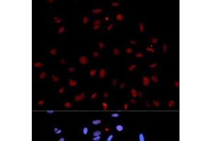 Immunofluorescence analysis of U2OS cells using Phospho-MET(Y1235) Polyclonal Antibody (c-MET 抗体  (pTyr1235))