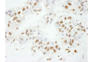 anti-Nuclear Transcription Factor Y, gamma (NFYC) (AA 408-458) antibody