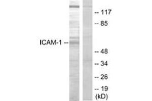 Western blot analysis of extracts from HepG2 cells, using ICAM-1 (Ab-512) Antibody. (ICAM1 抗体  (AA 479-528))