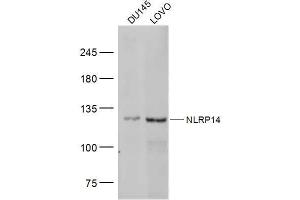 Lane 1: DU145 lysates Lane 2: LOVO lysates probed with NLRP14 Polyclonal Antibody, Unconjugated  at 1:300 dilution and 4˚C overnight incubation. (NLRP14 抗体  (AA 81-180))