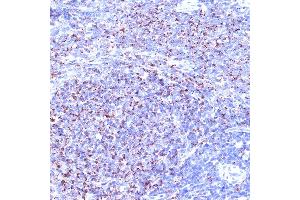 Immunohistochemistry of paraffin-embedded rat spleen using TC10/RHOQ Rabbit mAb (ABIN7269869) at dilution of 1:100 (40x lens). (RHOQ 抗体)