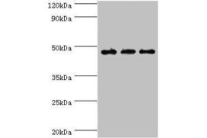 Western blot All lanes: PDK2 antibody at 6 μg/mL Lane 1: Mouse heart tissue Lane 2: Hela whole cell lysate Lane 2: Mouse skeletal muscle tissue Secondary Goat polyclonal to rabbit IgG at 1/10000 dilution Predicted band size: 47, 39 kDa Observed band size: 47 kDa (PDK2 抗体  (AA 128-407))