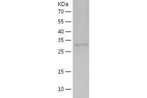 Western Blotting (WB) image for Coiled-Coil Domain Containing 69 (CCDC69) (AA 1-296) protein (His tag) (ABIN7122432) (CCDC69 Protein (AA 1-296) (His tag))