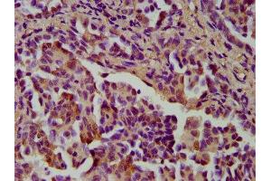 Immunohistochemistry (IHC) image for anti-Cystatin B (Stefin B) (CSTB) (AA 1-98) antibody (ABIN7148987)