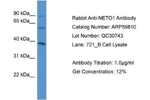 WB Suggested Anti-NETO1  Antibody Titration: 0. (NETO1 抗体  (C-Term))
