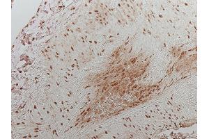 Image no. 5 for anti-Hypoxia Inducible Factor 1, alpha Subunit (Basic Helix-Loop-Helix Transcription Factor) (HIF1A) (AA 432-528) antibody (ABIN363203)