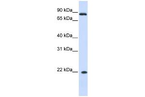 WB Suggested Anti-IFNA7 Antibody Titration: 0. (IFNA7 抗体  (N-Term))