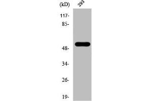 Western Blot analysis of 293 cells using Phospho-Cot (T290) Polyclonal Antibody (MAP3K8 抗体  (pThr290))