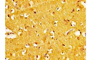 IHC image of ABIN7168283 diluted at 1:300 and staining in paraffin-embedded human brain tissue performed on a Leica BondTM system. (NAT1 抗体  (AA 909-1025))