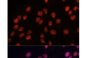 Immunofluorescence analysis of C6 cells using IPO8 Polyclonal Antibody at dilution of 1:100. (Importin 8 抗体)