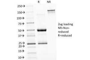 SDS-PAGE Analysis of Purified, BSA-Free ASRGL1 Antibody (clone CRASH/1289). (ASRGL1 抗体)