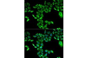 Immunofluorescence analysis of A-549 cells using FMO3 antibody (ABIN3015685, ABIN3015686, ABIN3015687 and ABIN6219039). (FMO3 抗体  (AA 263-532))