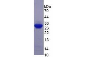 SDS-PAGE analysis of Human Semaphorin 5B Protein. (SEMA5B 蛋白)