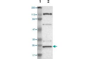 Western blot analysis of human cell line RT-4 with GCET2 polyclonal antibody .