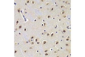 Immunohistochemistry of paraffin-embedded rat brain using CDKN1B Antibody. (CDKN1B 抗体)