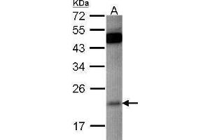 WB Image Sample (30 ug of whole cell lysate) A: HCT116 12% SDS PAGE antibody diluted at 1:500 (RAP1B 抗体)
