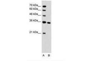 Image no. 1 for anti-Solute Carrier Family 25, Member 29 (SLC25A29) (C-Term) antibody (ABIN205008) (SLC25A29 抗体  (C-Term))