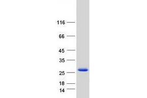 Western Blotting (WB) image for Mid1-Interacting Protein 1 (m1ip1) (Transcript Variant 3) protein (Myc-DYKDDDDK Tag) (ABIN2725994)
