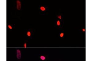 Immunofluorescence analysis of A431 cells using GTF2I Polyclonal Antibody at dilution of 1:100. (GTF2I 抗体)
