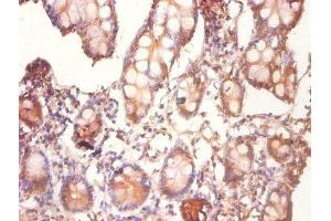 Immunohistochemistry of paraffin-embedded human small intestine tissue using ABIN7148869 at dilution of 1:100 (CDK2AP1 抗体  (AA 1-115))