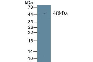 Detection of Recombinant ISLR, Human using Monoclonal Antibody to Immunoglobulin Superfamily Containing Leucine Rich Repeat Protein (ISLR) (ISLR 抗体  (AA 19-428))