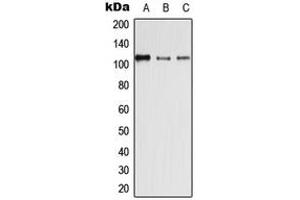 Western blot analysis of Desmoglein 4 expression in HEK293T (A), SP2/0 (B), H9C2 (C) whole cell lysates. (Desmoglein 4 抗体  (Center))