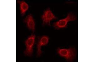 ABIN6275615 staining Hela by IF/ICC. (SVOP 抗体  (Internal Region))