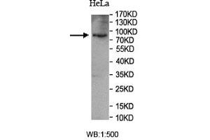 Western blot analysis of HeLa cell lysate, using SUN1 antibody. (SUN1 抗体  (AA 22-173))