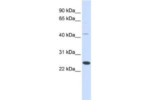WB Suggested Anti-FAM119A Antibody Titration: 0. (FAM119A 抗体  (Middle Region))