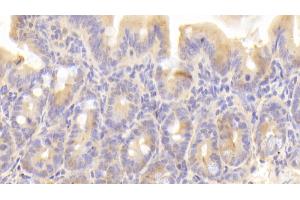 Detection of CYPA in Mouse Small intestine Tissue using Polyclonal Antibody to Cyclophilin A (CYPA) (PPIA 抗体  (AA 2-164))