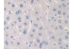 Detection of PKD2 in Human Liver Tissue using Polyclonal Antibody to Protein Kinase D2 (PKD2) (PKD2 抗体  (AA 621-832))