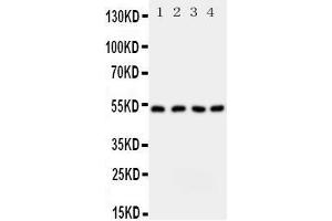 Western Blotting (WB) image for anti-serine Palmitoyltransferase, Long Chain Base Subunit 1 (SPTLC1) (AA 138-154), (Middle Region) antibody (ABIN3043056) (SPTLC1 抗体  (Middle Region))