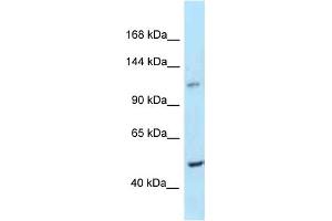 WB Suggested Anti-Ppip5k2 Antibody Titration: 1. (HISPPD1 抗体  (C-Term))