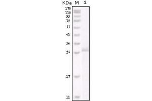Western blot analysis using HER-2 antibody against truncated HER-2 recombinant protein. (ErbB2/Her2 抗体)