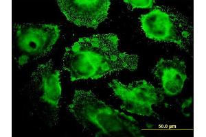 Immunofluorescence of monoclonal antibody to MRPL12 on HeLa cell. (MRPL12 抗体  (AA 1-198))