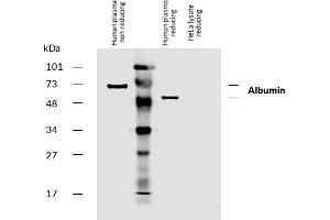 Western blotting analysis of human serum albumin using mouse monoclonal antibody AL-01 on human plasma and lysate of HeLa cell line (albumin non-expressing cell line, negative control) under non-reducing and reducing conditions.