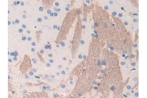 DAB staining on IHC-P; Samples: Mouse Cerebrum Tissue (Fibrinogen beta Chain 抗体  (AA 35-481))