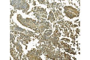IHC analysis of MEK2/MAP2K2 using anti-MEK2/MAP2K2 antibody (ABIN7599357). (MEK2 抗体  (AA 1-400))