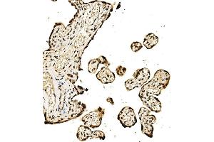 IHC analysis of SPHK1 using anti-SPHK1 antibody (ABIN7600168).