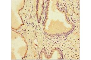 Immunohistochemistry (IHC) image for anti-SWI/SNF Related, Matrix Associated, Actin Dependent Regulator of Chromatin, Subfamily A, Member 1 (SMARCA1) (AA 500-601) antibody (ABIN7164517)