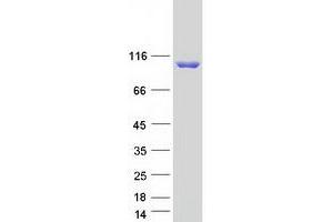 Validation with Western Blot (CARNS1 Protein (Transcript Variant 1) (Myc-DYKDDDDK Tag))