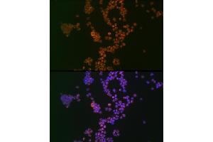 Immunofluorescence analysis of Jurkat cells using Ikaros Rabbit mAb (ABIN7267841) at dilution of 1:100 (40x lens). (IKZF1 抗体)