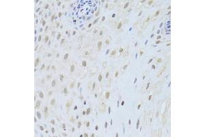 Immunohistochemistry of paraffin-embedded human esophagus using AIFM1 Antibody (ABIN5971393) at dilution of 1/200 (40x lens). (AIF 抗体)