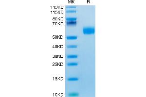 Mouse IL-3 on Tris-Bis PAGE under reduced condition. (IL-3 Protein (AA 27-166) (Fc Tag))