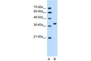 WB Suggested Anti-RUNDC2A Antibody Titration:  5. (SNX29 抗体  (N-Term))